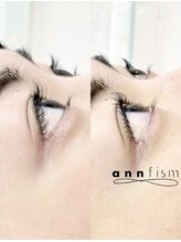 アンフィズム(annfism)