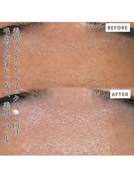 クラルテアンドコー(Salon Clarte&Co.)/自慢の美肌フェイシャルワックス