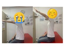 ナオル整体 浦添院(NAORU整体)/50代　女性　肩ビフォーアフター