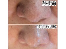 ククナ(kukuna)の雰囲気（毛穴キレイと癒しが叶うサロン！本気の毛穴エステ）