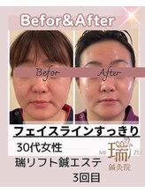 瑞 鍼灸院/ビフォー・アフター♪