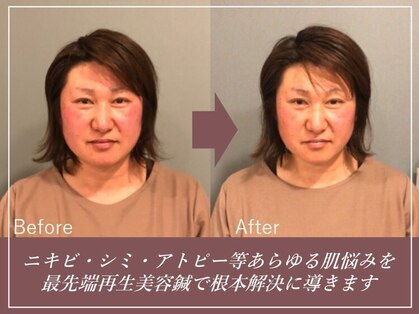 鍼灸整骨院 レメディの写真