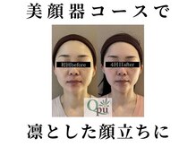 キュープ 函館店(Qpu)/美顔器モニターコース4回の変化