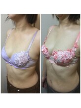 ロータス(Lotus)/40代　(左)ビフォー(右)アフター
