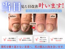 ブルームーンネイルズ(BLOOMOON.nails)