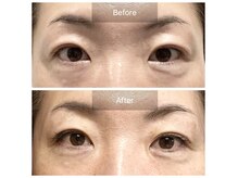 しわ・たるみ専用美顔サロン　Avelleの雰囲気（50代/目元のたるみ/シワ/目が開き/まぶたのたるみ/二重ライン）