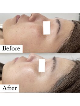 ウルル(ULuLu)/ビフォーアフター