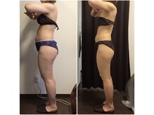 美やせ専門店 ビープロデュース 西尾店(B'PRODUCE)/【30代の方のビフォーアフター】