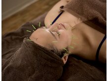 ハリルル 併設 GLケンタ鍼灸整骨院(HARILULU)/お顔のコリすっきり/小顔