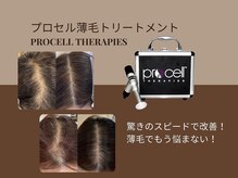 ジュパール(je pars)の雰囲気（滋賀県希少/ダウンタイムなし！育毛促進ケアプロセルセラピーズ）