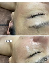 ラブニール 横浜店/スーパーフードワックスフェイス