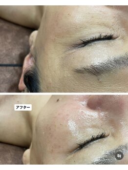 ラブニール 横浜店/スーパーフードワックスフェイス