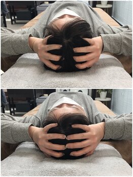 カルペード 中百舌鳥/なかもず院(Carpe D.)/施術後の変化