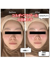 チョアチョア 札幌すすきの店(CHOA-CHOA)/