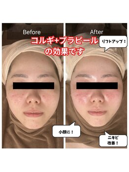 チョアチョア 札幌すすきの店(CHOA-CHOA)/