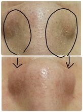 ハルリ(Haruri)/長年のお悩みも一度でスッキリ