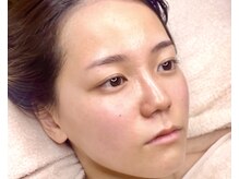 エミレ(emire)の雰囲気(フェイシャルワックス脱毛(顔脱毛)◇産毛,角質を除去し美肌へ)