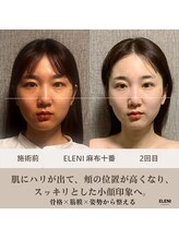 エレーニ 麻布十番(ELENI)/継続することで鏡見るのが楽しみ