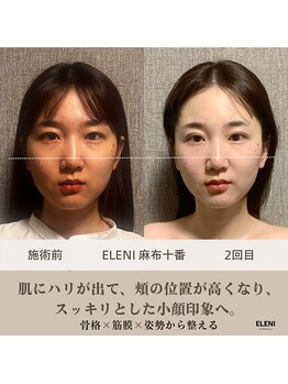 エレーニ 麻布十番(ELENI)/継続することで鏡見るのが楽しみ