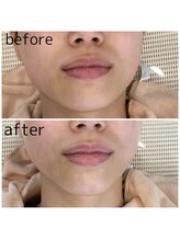 レイネイル レイエステティック 岐阜茜部店(RAY NAIL & RAY ESTHETIC)/コルギ・オールハンド