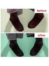 ナオル整体 福岡香椎院(NAORU整体)/30代女性施術事例【骨盤の歪み】