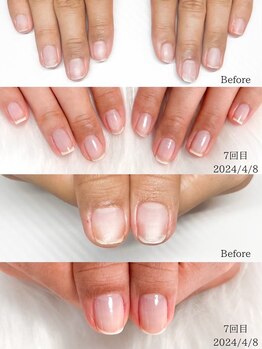 爪悩みラピネスにお任せください