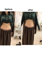 ジョワイユ(Joyeux)/腸の位置でお腹は変わる