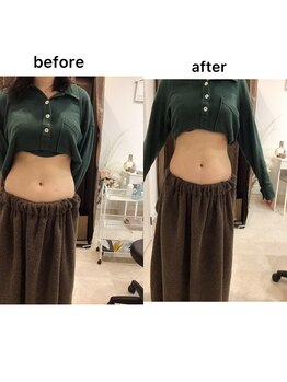 ジョワイユ(Joyeux)/腸の位置でお腹は変わる