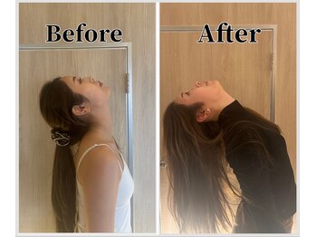 整体ラルース 中目黒(LALUZ)/20代女性 ストレートネック改善