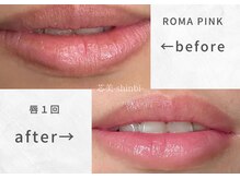 芯美 恵比寿店(shinbi)/ローマピンク 唇1回