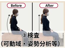 イーグル整骨院 幸町店/お悩みに合わせて検査◎