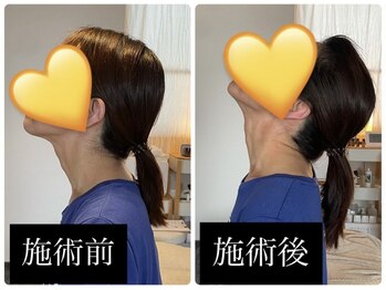 ラシネス(Racines)/筋膜ケア