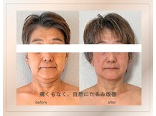 アトリエドゥアージュ(Atelier de age)