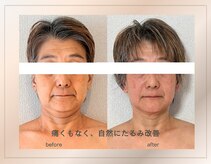 アトリエドゥアージュ(Atelier de age)