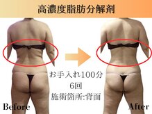 フェアリー 小松店の雰囲気（【結果主義サロン】リバウンドしない体作りを全力サポート♪）