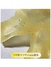 マツヤニwaxパッチテストご希望の方