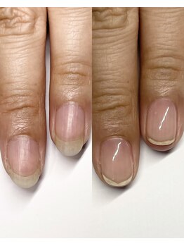 ルジュア(Lujyua)/自爪育成