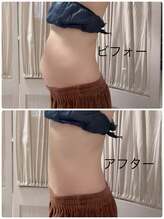 メディカルエステ ユウ(Yuu)/たぷたぷお腹スッキリ♪