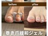 【フット】巻き爪ケア★親指２本＋10本ワンカラー11,000→10,000円（ラメOK）