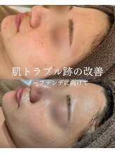 インテリウス(INteRius.)/目指せノーファンデ肌