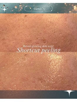 クラルテアンドコー(Salon Clarte&Co.)/韓国海洋性ハーブピーリング/2回