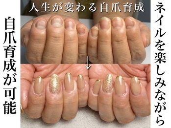 リリーの写真/【理想の美爪が叶う*】指先や手元をキレイに見せるナチュラルカラーやデザインでいつもと違う毎日に♪