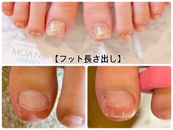 モアニヒロオ 広尾駅前店(MOANI Hiroo)/フット長さ出し☆