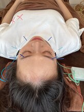 ハリファ鍼灸院 横浜関内院(HariFa鍼灸院)/美容施術