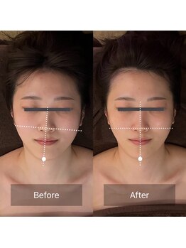 アン シェリー(un Cherie)/お顔の歪みが左右対称に!