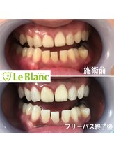 ルブラン 奈良店(Le Blanc)/連休中に！