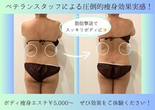 リシェル