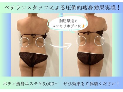 リシェルの写真