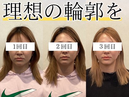 アズイズビューティー 草津店の写真