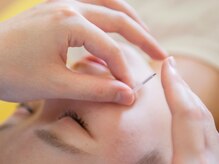 ゆめたか接骨院 鍼灸院 整体院 大沢野院/幹細胞美容液導入でさらに効果◎